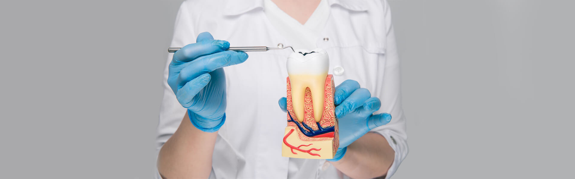 Can An Emergency Dentist Do A Root Canal?