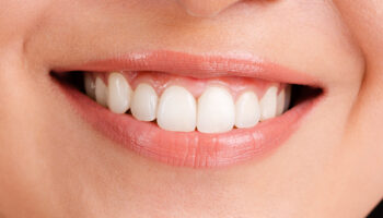 Lost a Tooth? Best Options for Restoring Your Smile